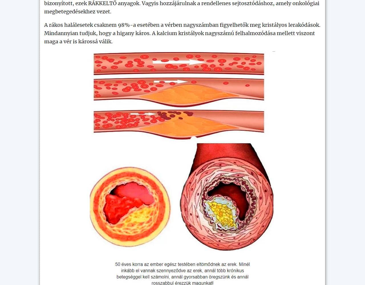 Cardiotensive 5