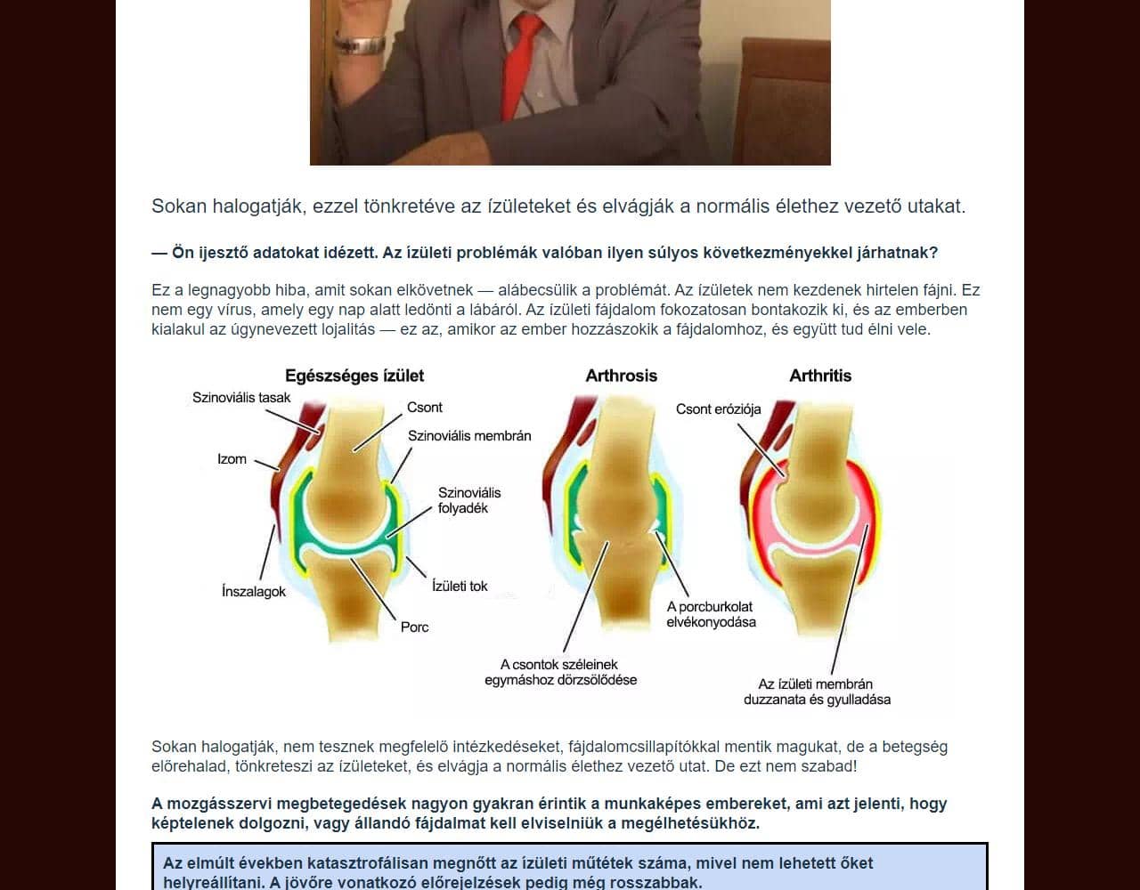 Osteon gel 5